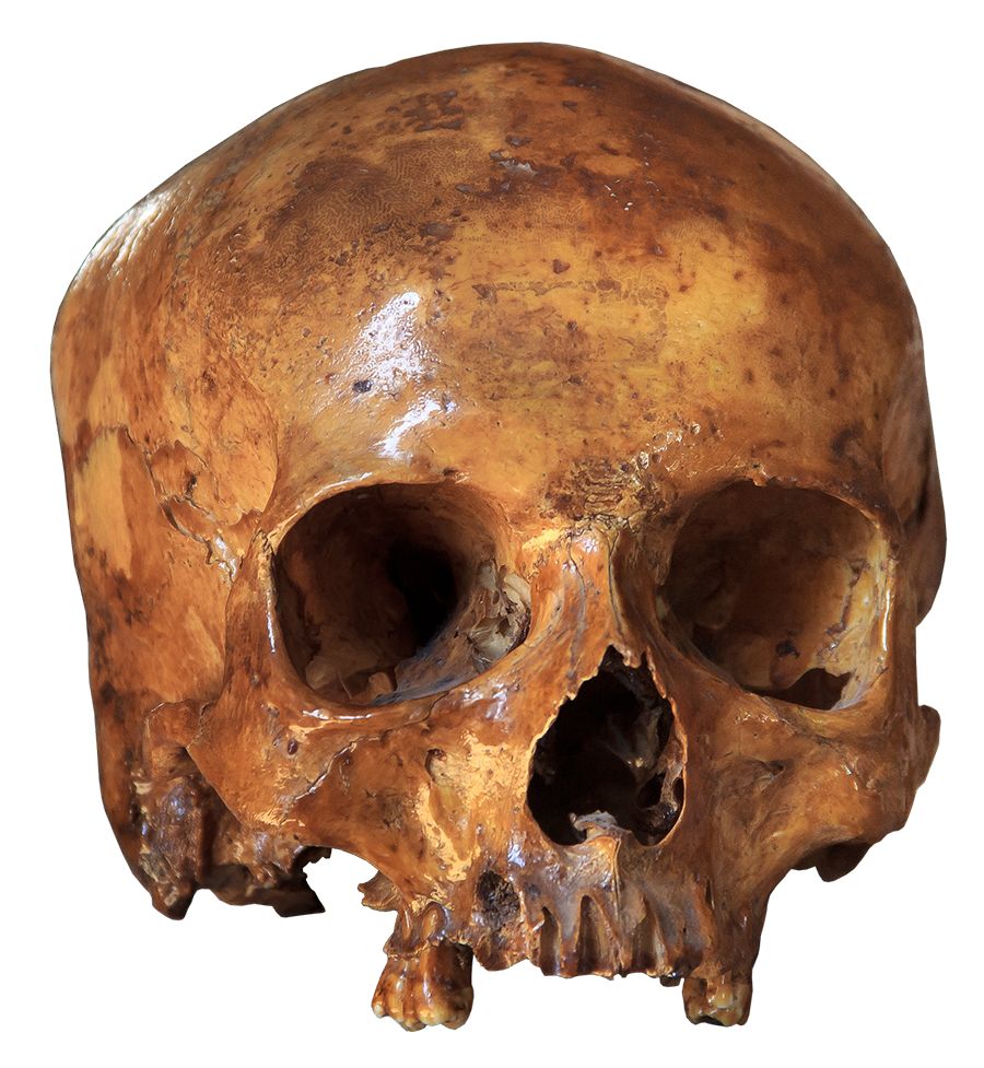 Human skull missing the lower jaw.